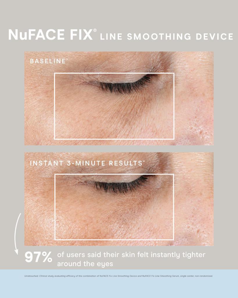 商品NuFace|Fix Device with Serum,价格¥1189,第5张图片详细描述
