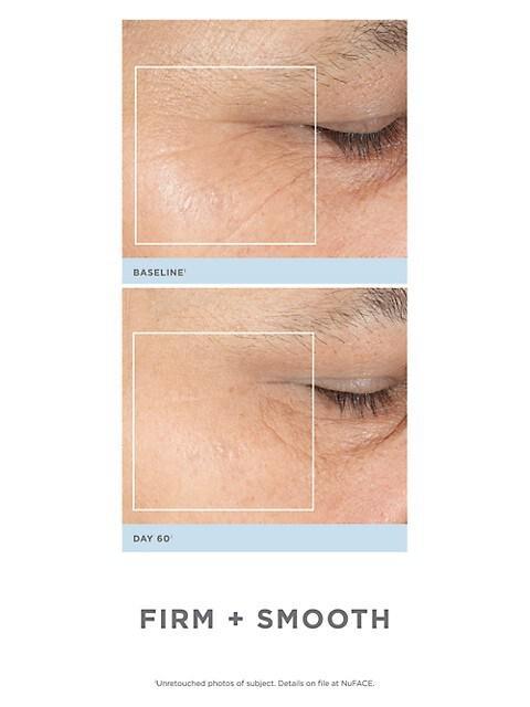 商品NuFace|Trinity® Precision Facial Toning Kit With Effective Lip & Eye Attachment,价格¥3357,第5张图片详细描述