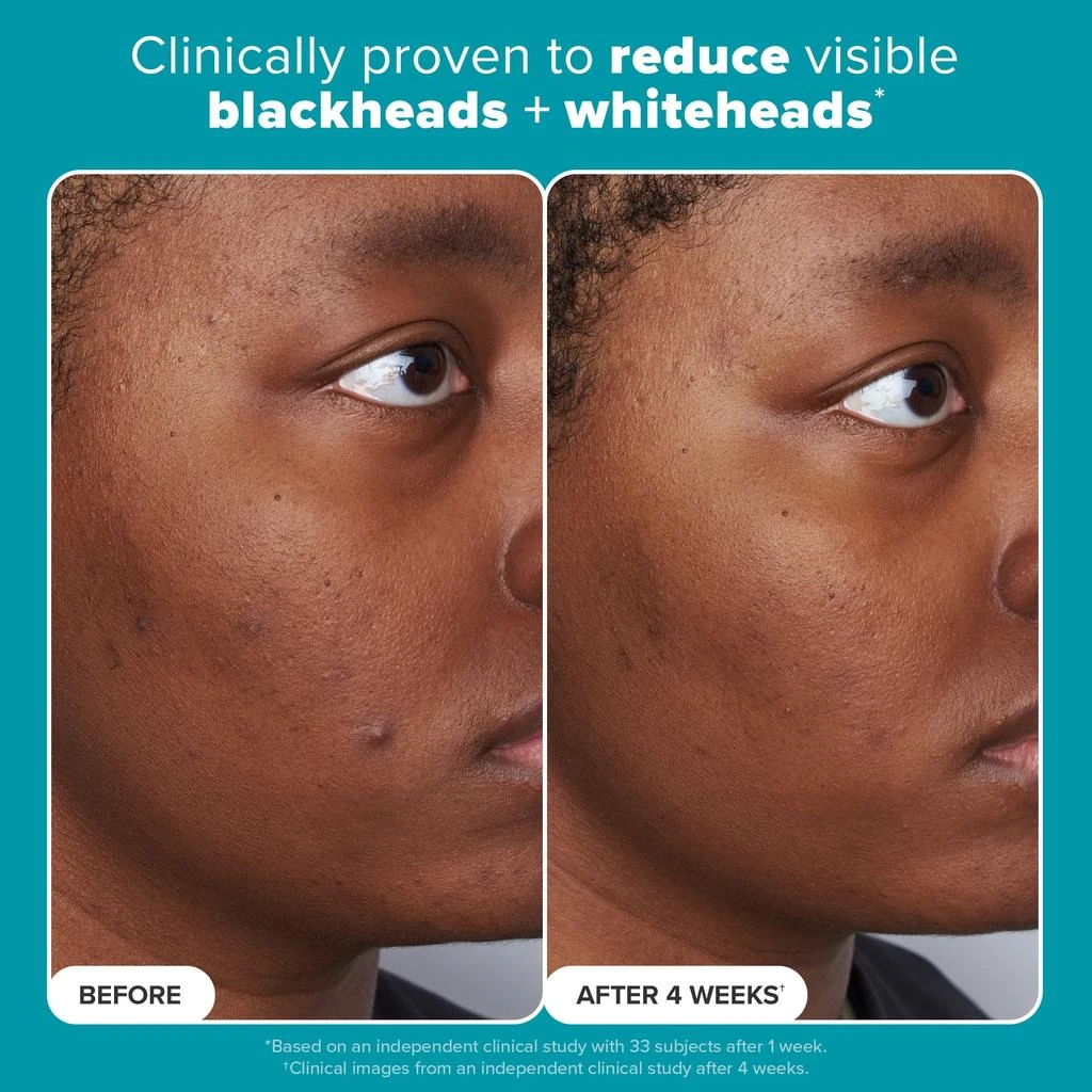 Paula's Choice SKIN PERFECTING 2 BHA Liquid Exfoliant 商品