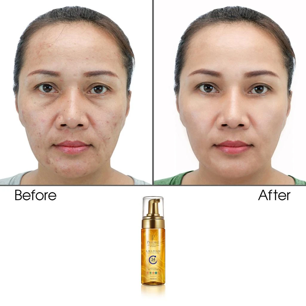 商品Predire Paris|Hydrating Lava Foam Facial Cleanser (Rich with Vitamin E & A),价格¥231,第2张图片详细描述