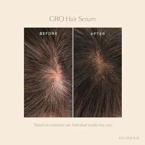 商品Vegamour|GRO Hair Serum & Biotin Gummies Set for Thinning Hair,价格¥593,第2张图片详细描述