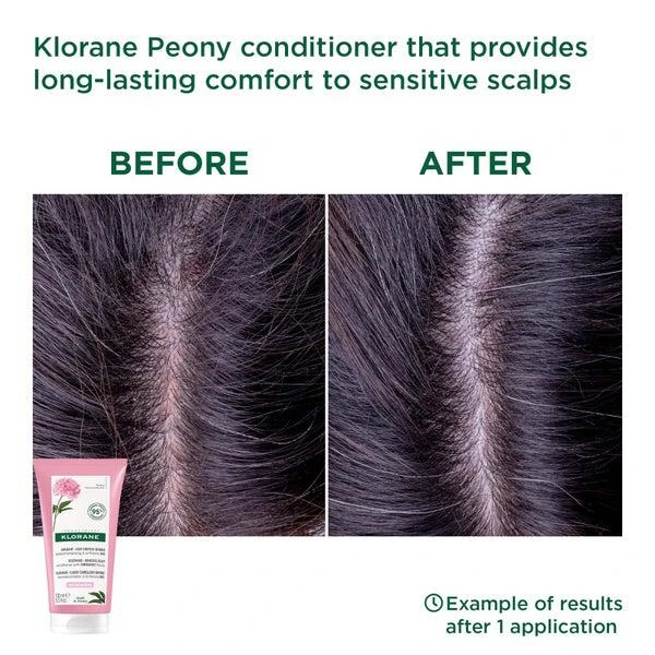 商品KLORANE|KLORANE Soothing Conditioner with Organic Peony for Sensitive Scalps 150ml,价格¥186,第2张图片详细描述