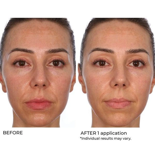 NassifMD Dermaceuticals Hydro-Gel with Hyaluronic Acid, Retinol and Salicylic Acid 50ml 商品