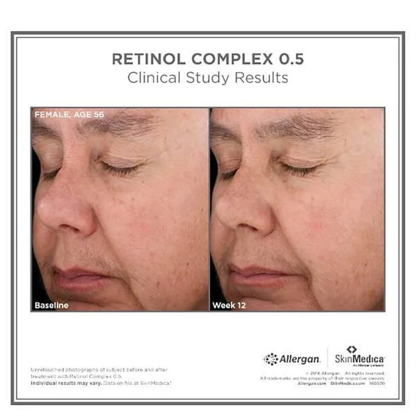 商品SkinMedica|SkinMedica Retinol Complex 0.5 and TNS Recovery Complex,价格¥2046,第2张图片详细描述