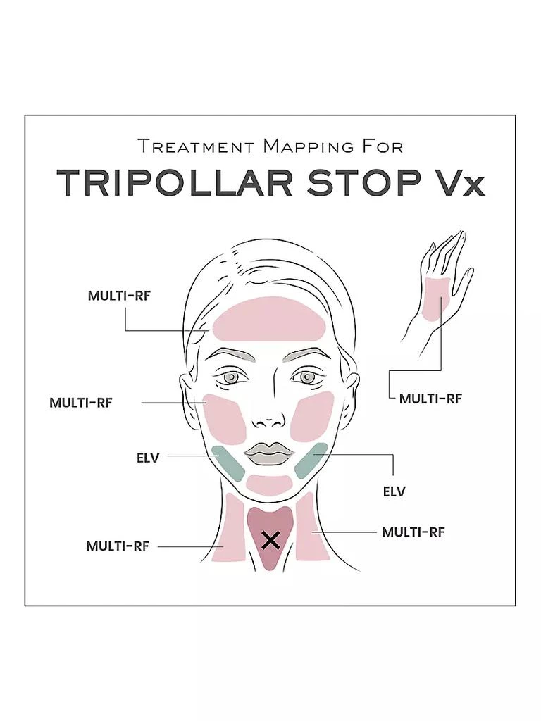 TriPollar STOP Vx Facial Renewal, Reshaping & Rejuvenation Device 商品