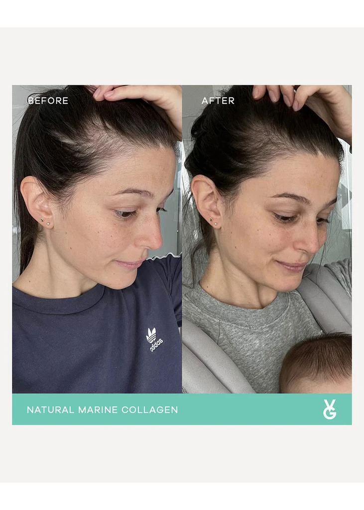商品Vida Glow|Mixed Natural Marine Collagen Trial Pack – 14 servings,价格¥249,第5张图片详细描述
