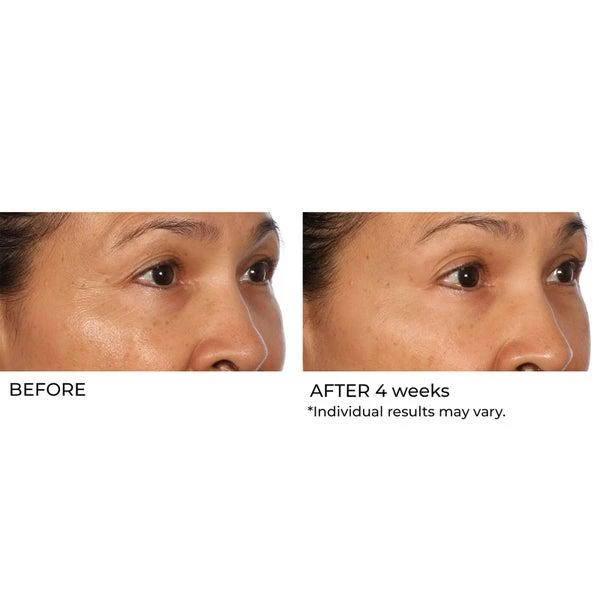 NassifMD Dermaceuticals Hydro-Gel with Hyaluronic Acid, Retinol and Salicylic Acid 50ml 商品